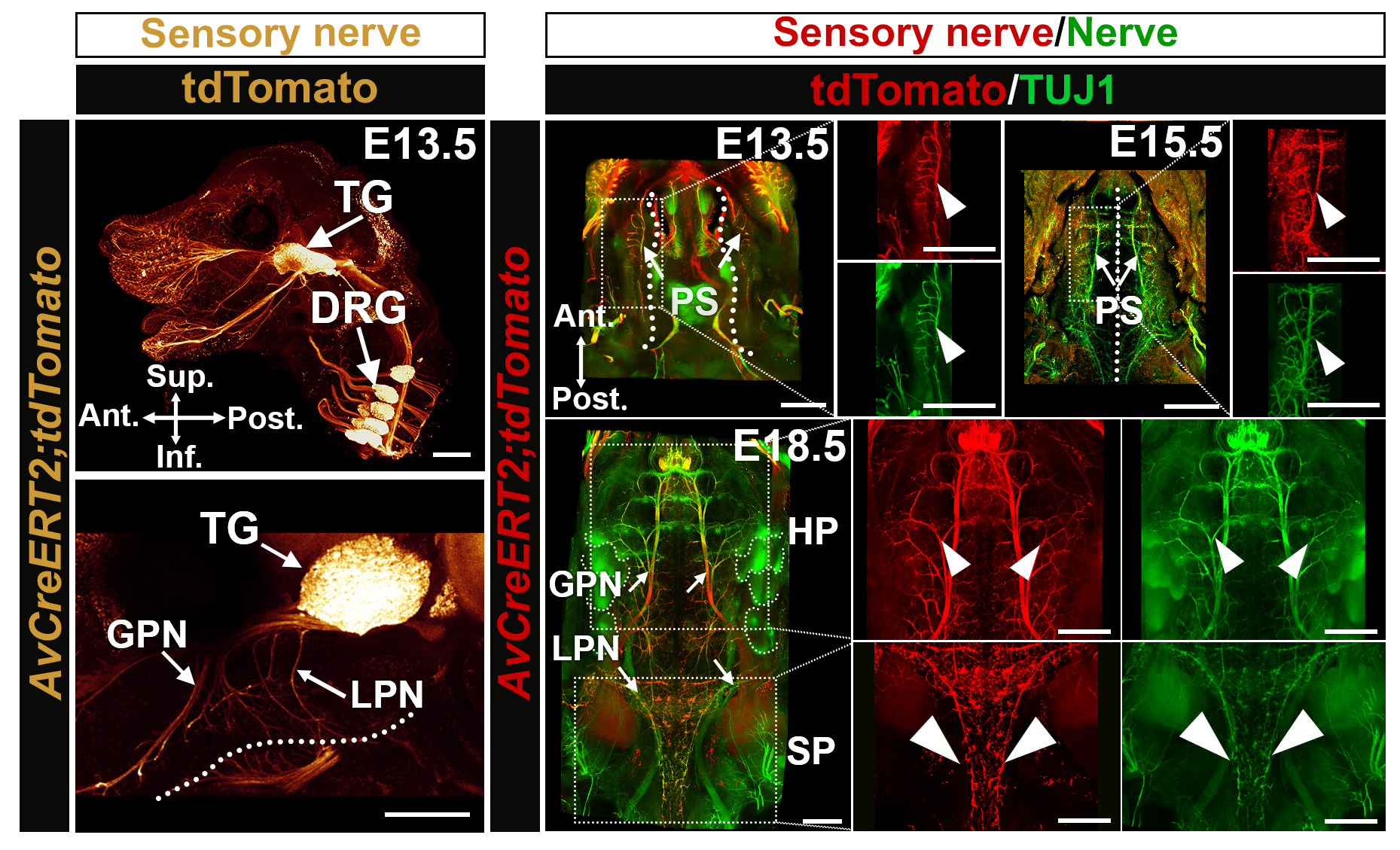 Sensory innervation of the developing mouse palate.